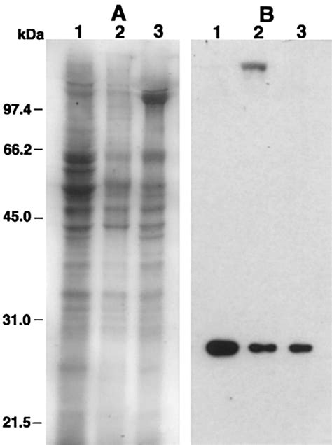 Neuron Specific PGP9 5 Expression In Rat Hair Follicle Development And