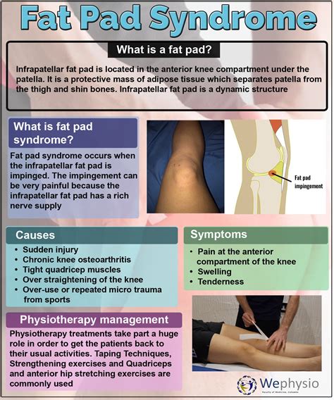 Wephysio - Fat Pad Syndrome Fat pad syndrome is a common cause of