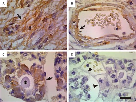 Vimentin Expression In Normal Human Pituitary Tissue Posterior