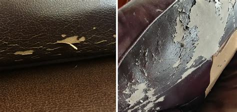 Leather Sofa Peeling How To Repair At Anthony Gibbons Blog