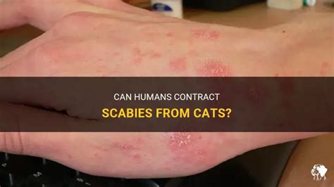 Can Humans Contract Scabies From Cats Petshun