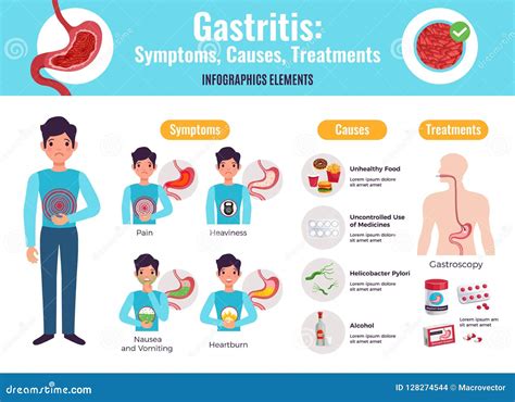 Cartel De Infographic De La Gastritis Ilustración Del Vector