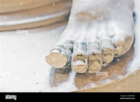 Vintage Leg Cast Hi Res Stock Photography And Images Alamy