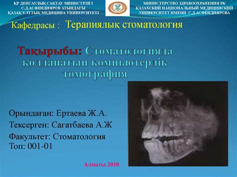 Стоматологияда қолданатын компьютерлік томография - презентация онлайн