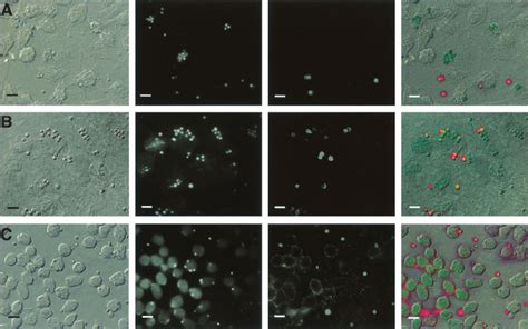 Immuno Fl Uorescence Microscopy Demonstrates Phagocytosis Of A