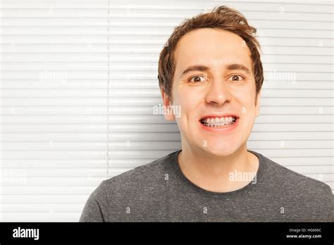 Dental Braces Hi Res Stock Photography And Images Alamy