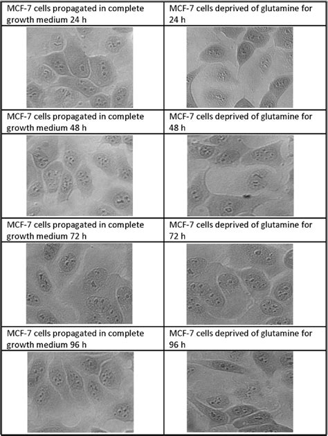 Light Microscopy Images Demonstrating Morphology Of Mcf Cells After