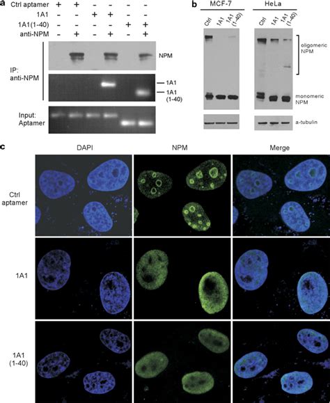 Nucleophosmin Npm Aptamers Interfere With The Oligomerization And