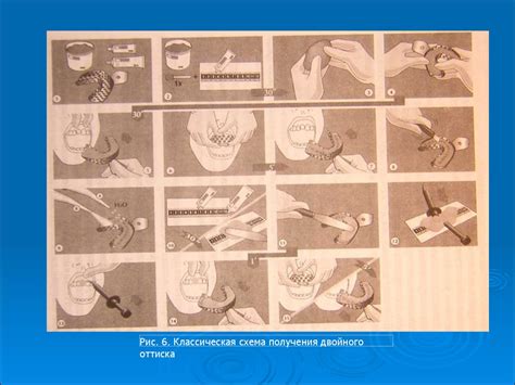 Оттискные (слепочные) материалы. Классификация, показания к применению ...