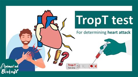 Tropt Test What If Trop T Test Is Positive Troponin T Blood Test