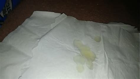 Hypospadias Videos XVIDEOS