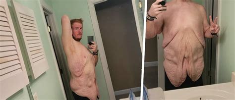 Casey King Before And After 4 Weight Loss Tips From Him