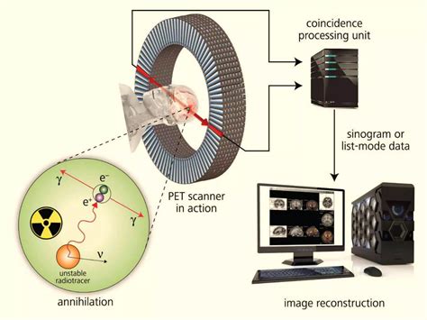 Positron Emissions Tomography (PET SCAN) | PPTX