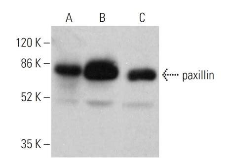 paxillin Antibody (A-5) | SCBT - Santa Cruz Biotechnology 