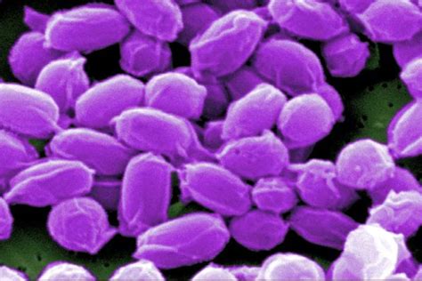 Anthrax Vaccine Funding Urged Amid West Africa Outbreak