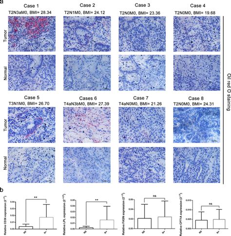 Oil red O staining of lipids in human tissue samples. a Detection of