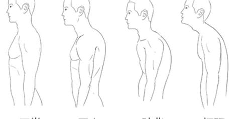 怎么纠正驼背最有效的方法（驼背人群越来越多？有好办法吗？） 说明书网
