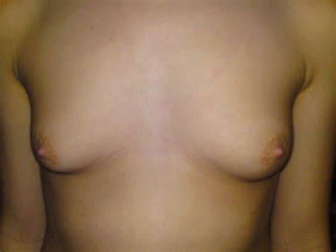 Amateur Lovers Nude Photos Porn Pic