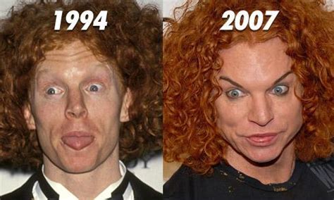 Plastic Surgery Gone Wrong
