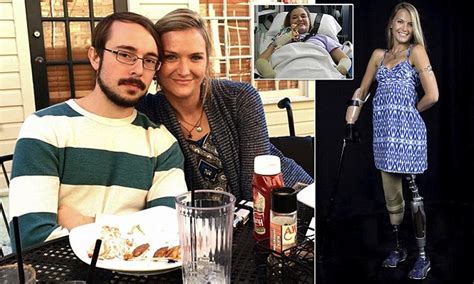 Aimee Copeland Who Lost All Her Limbs To Flesh Eating Bug Found Her