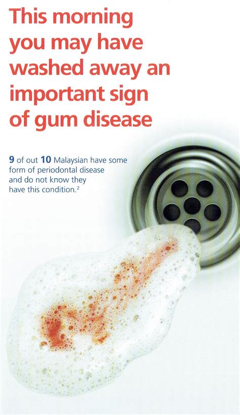 how to tell if you have gum disease 3