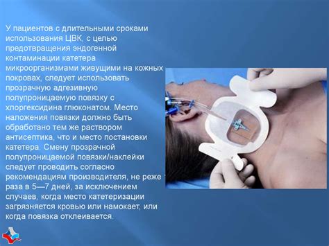 Профилактика катетер – ассоциированных инфекций кровотока (КАИК) и уход ...