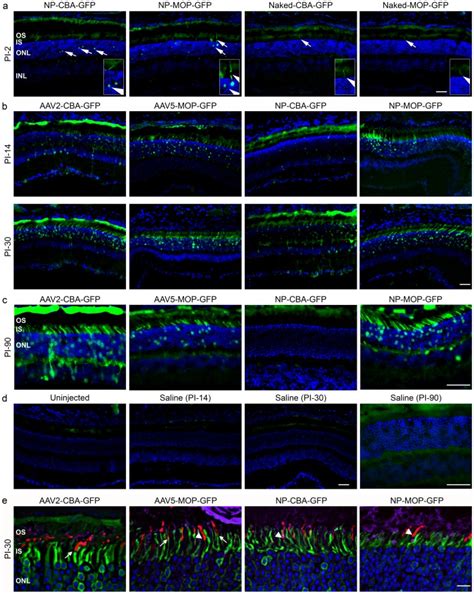 Balb C Mice Were Subretinally Injected At P30 With Naked CBA GFP