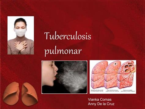 Tuberculosis Pulmonar Ppt