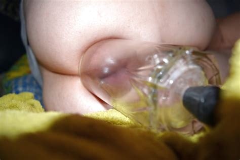 Anal Pumping Pics Xhamster