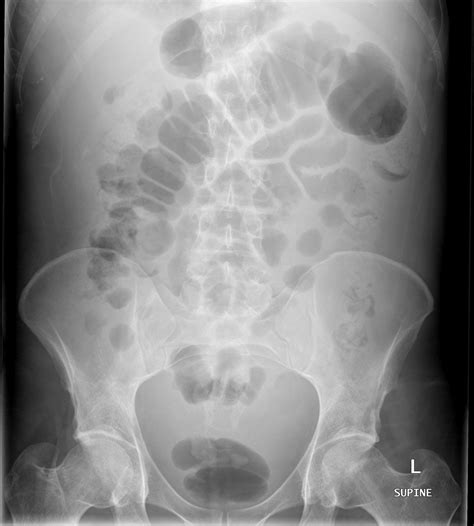 What Does A Dog Chest X Ray Show