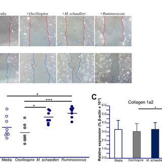 Tl1a-Tg mice have increased intestinal inflammation and collagen ...