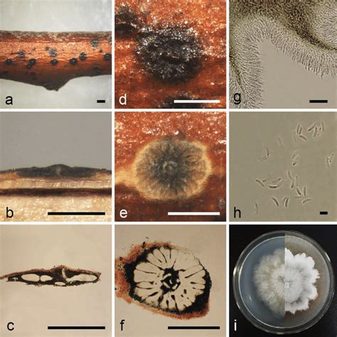 Morphology Of Cytospora Elaeagni From Elaeagnus Angustifolia