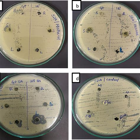 Antifungal Activity Of Plant Extracts Against Candida Albicans By Agar