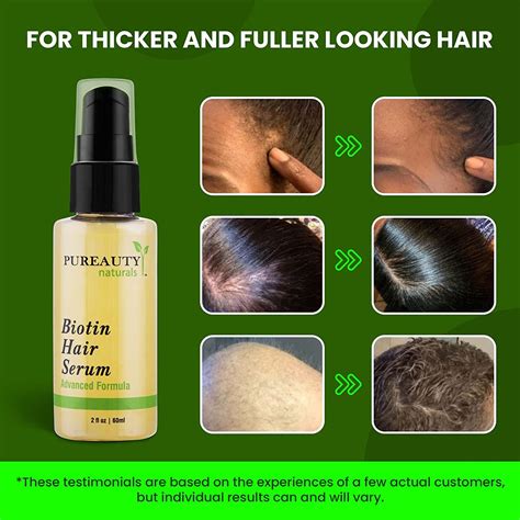 Biotin Hair Growth Serum Biotin Serum And Hair Growth Oil And Hair Serum Topical Hair Growth