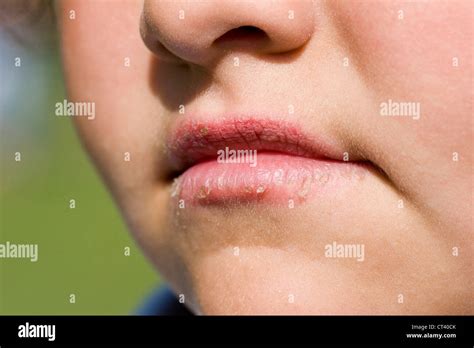 Lip Chapping Hi Res Stock Photography And Images Alamy