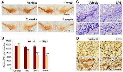 Progressive Degeneration Of The Nigral Dopaminergic Neurons After