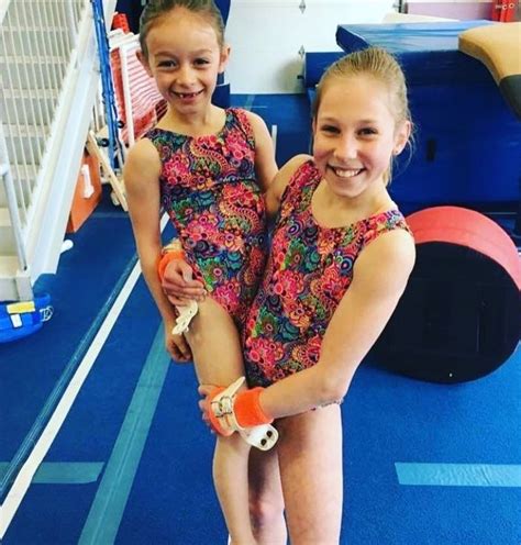 Julietta And Magdalena Gymnast Identical Twins With Mirrored Vulvas Imgur Hot Sex Picture