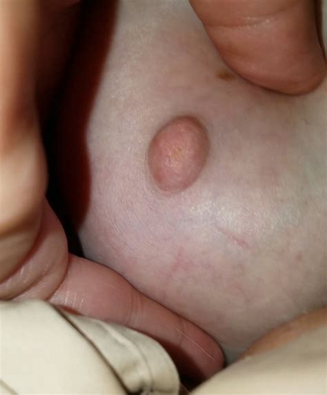 Ugly Pig Wife Chris Shows Her Saggy Boobs Porn Pictures XXX Photos Sex Images PICTOA