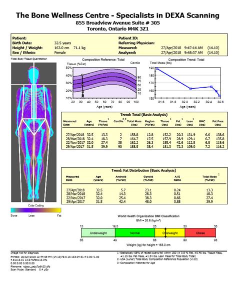 Dexa Scan Toronto Body Composition And Fat Scan Near Gta