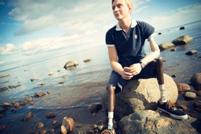 Gay Amputee Tumblr Tumbex