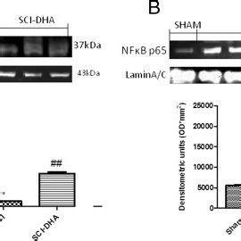 Effects of DHA treatment on IκBα and nuclear NF κB p65 By Western blot