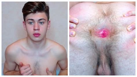 Gay Ass Twink Pink Hole Thisvid