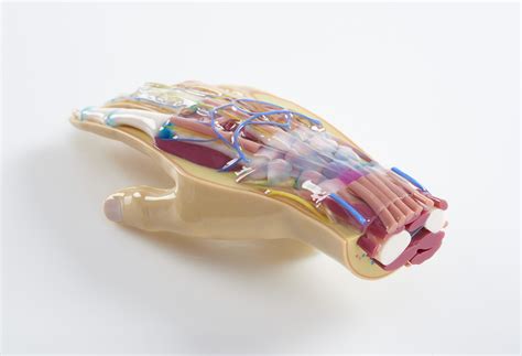 Kidneys and Child Hearts - Our Recent Real World Experiences with 3D