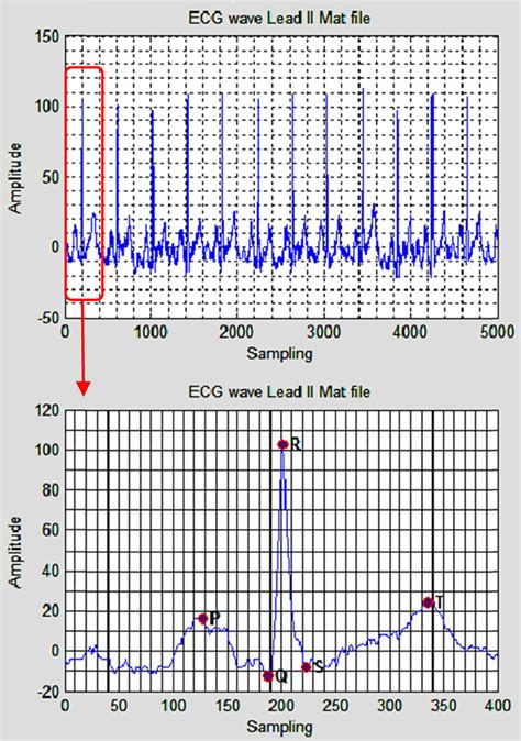 length   normal ecg wave  scientific diagram