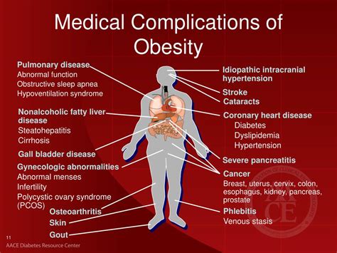 PPT - Management of Common Comorbidities in Diabetes PowerPoint ...