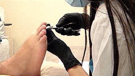 MISS LOVE Medical Pedicure For A Naked Hairy Man And Toe Foot