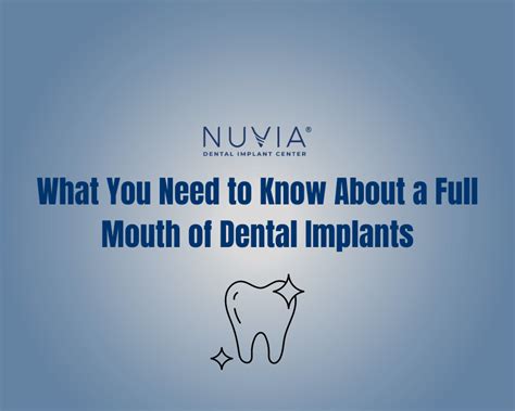What You Need To Know About A Full Mouth Of Dental Implants