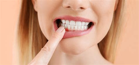 Tengo Las Encías Inflamadas ¿por Qué Puede Ser Nuño Gil