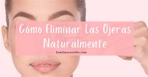 Como Eliminar Las Ojeras Naturalmente Esmilna Castillo