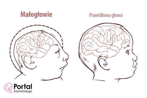 Małogłowie Portal Kosmetologa